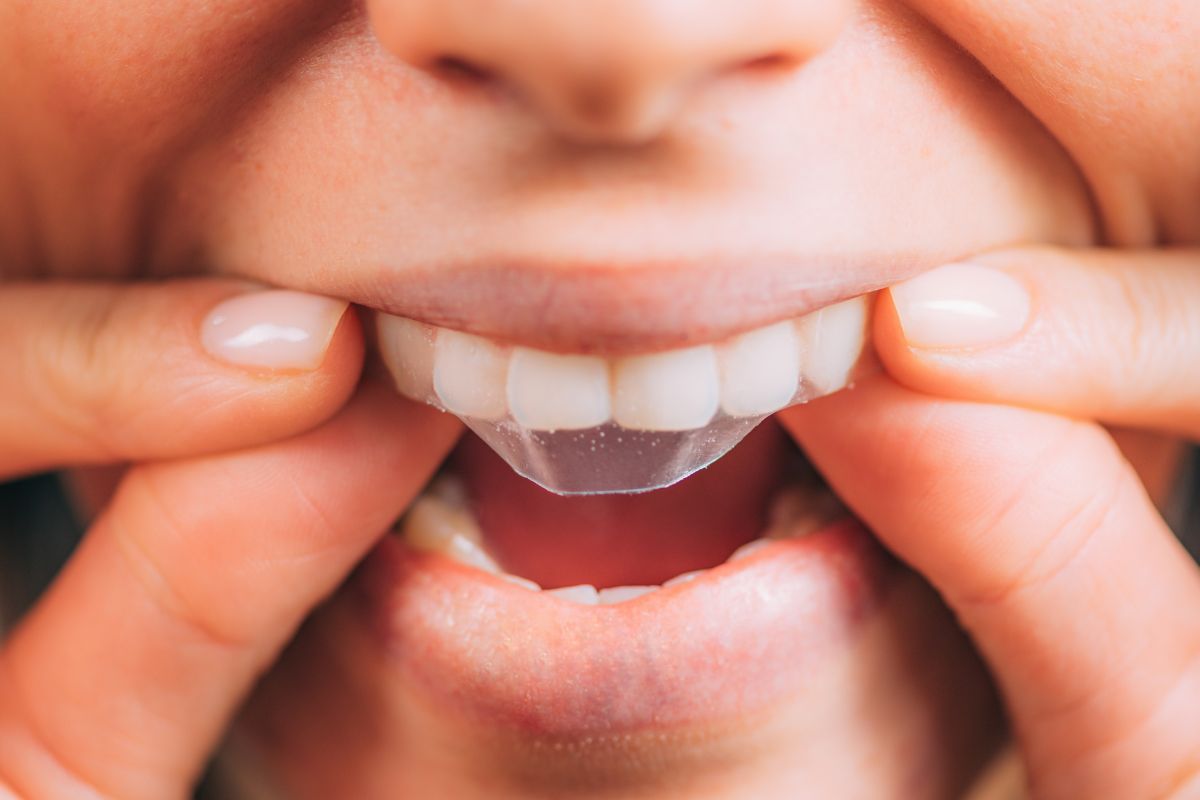 Are Teeth Whitening Strips Bad for Your Teeth