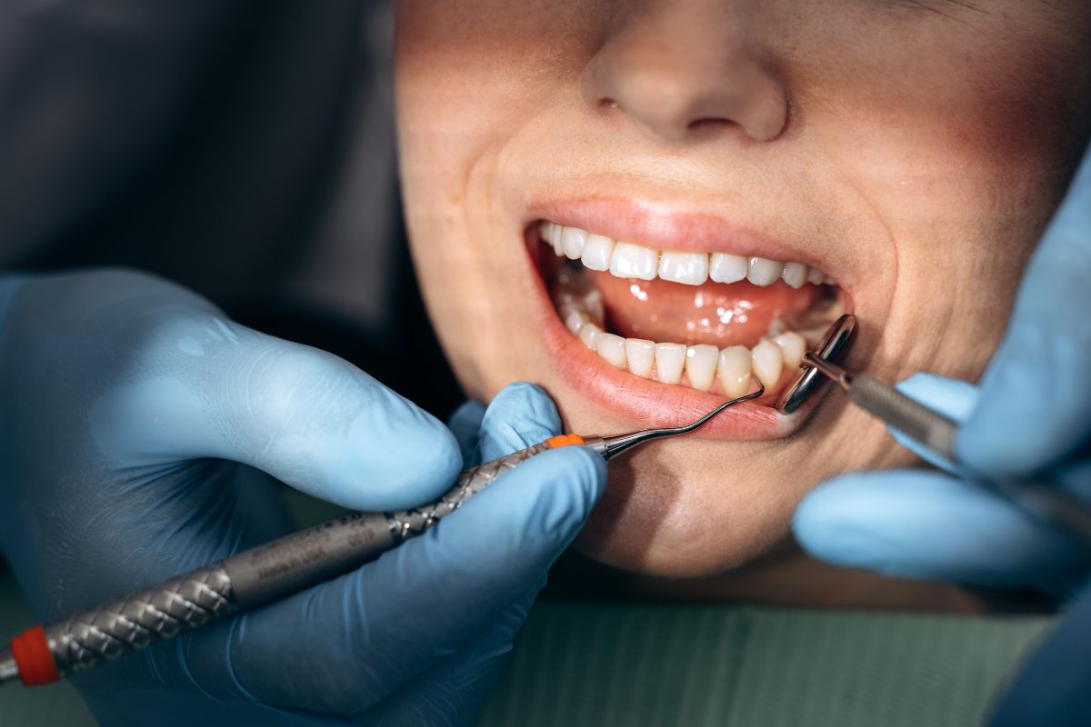 Sensitive Teeth Treatment in Stuart