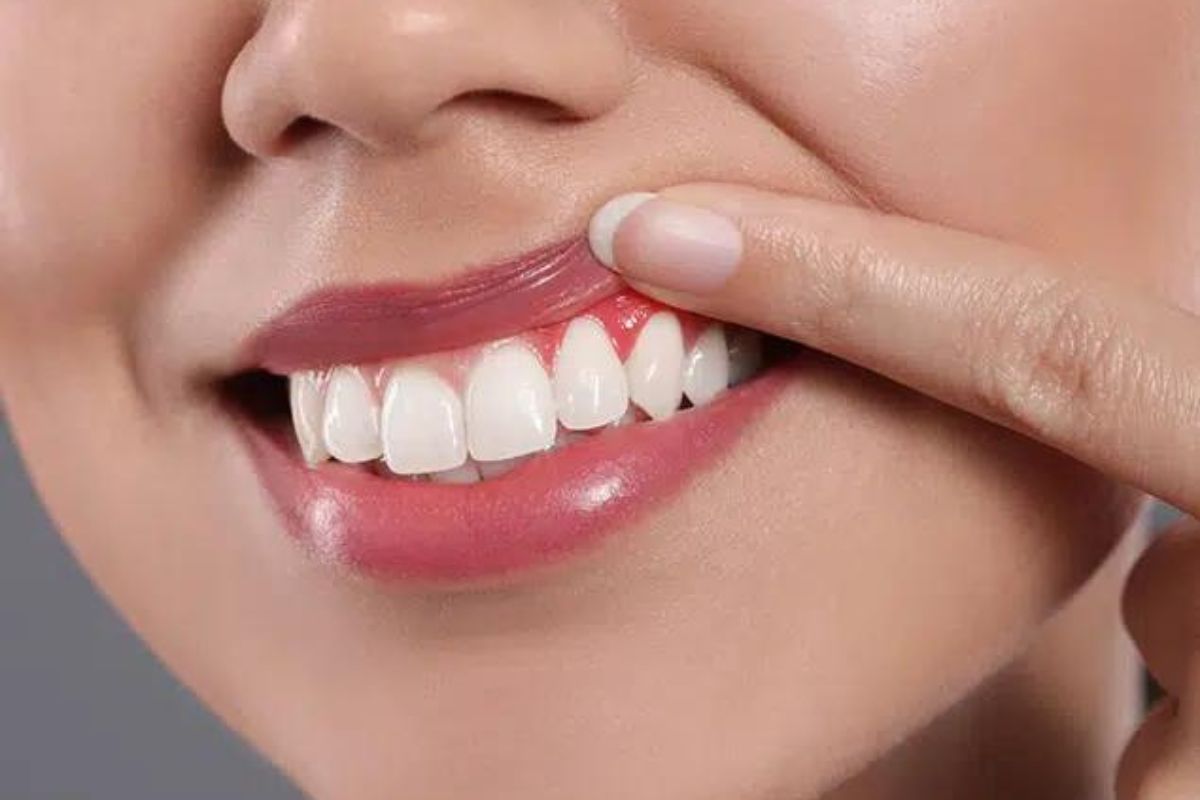 Bleeding Gums Explained Why Better Oral Hygiene Is the Solution Not the Problem