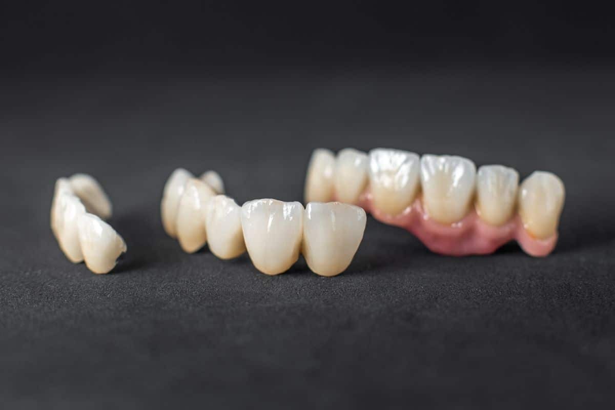 Dental crown samples in cream and tooth-colored porcelain with pink gum-colored base on dark background.