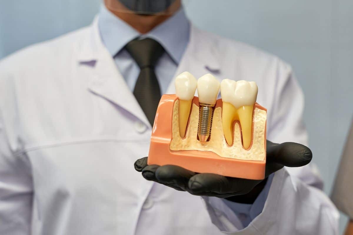 Dentist holding dental implant model showing tooth replacement options in Stuart, Florida.