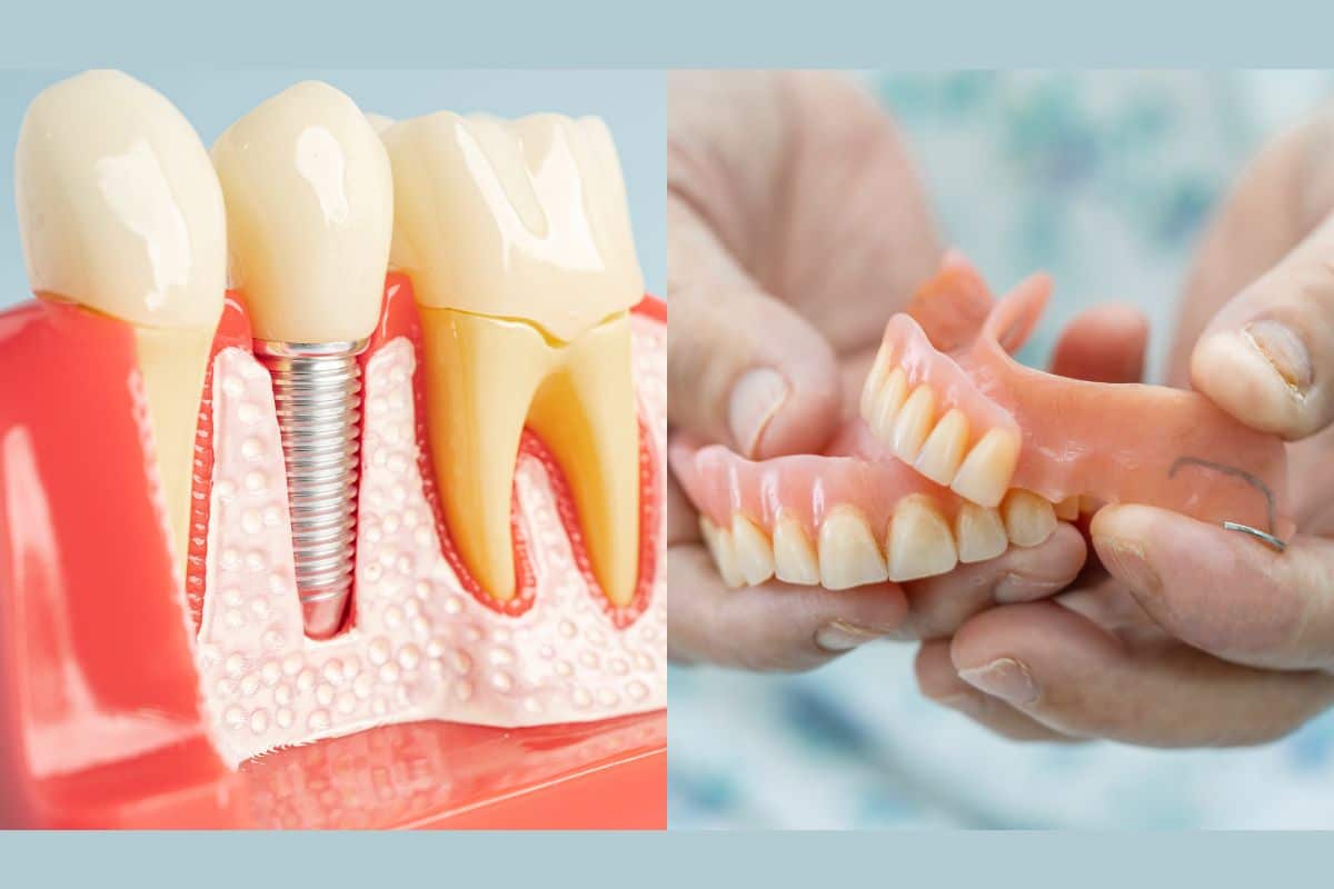 Dental Implants vs. Dentures