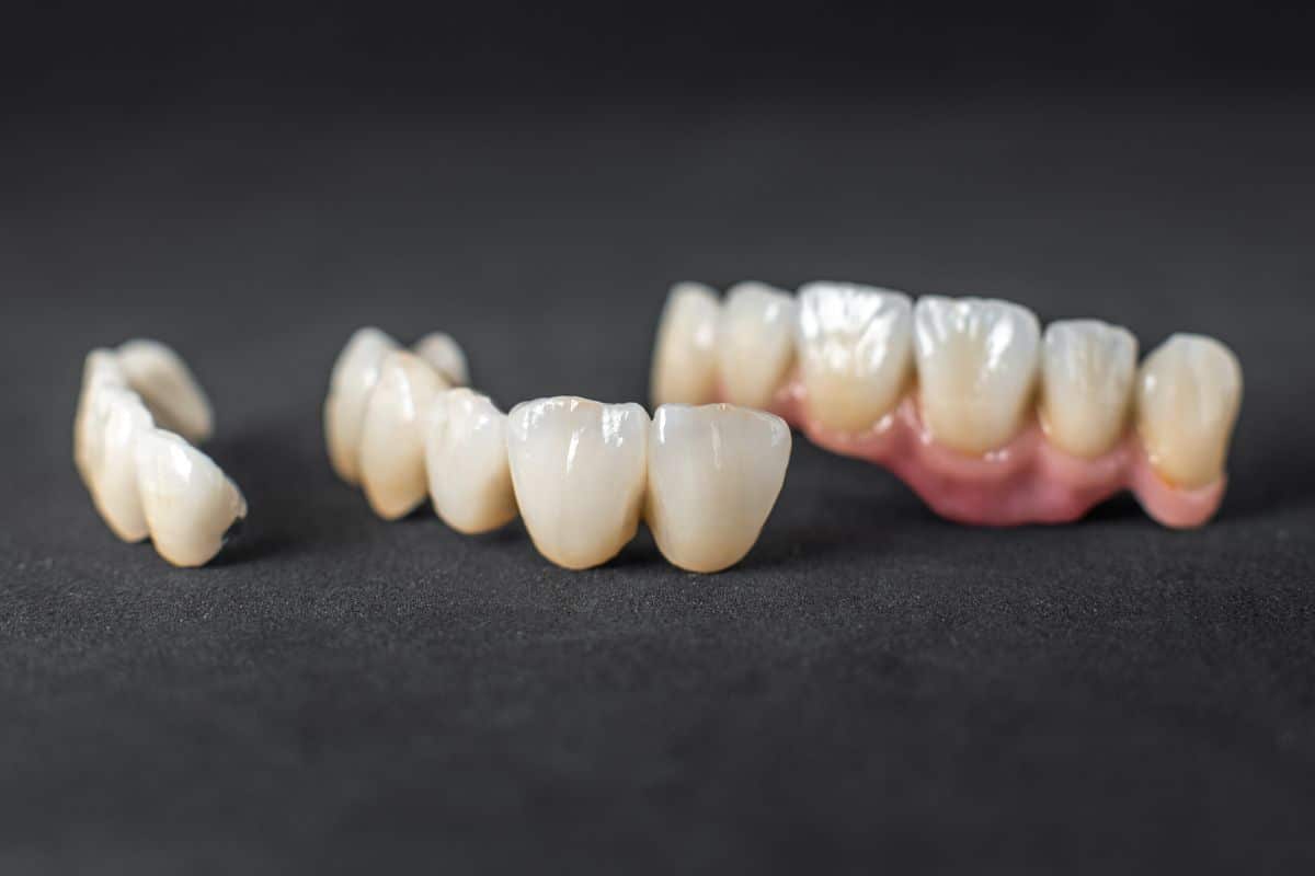 How Long Do Dental Crowns Last